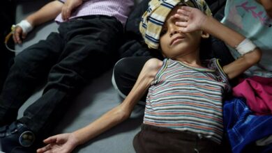 9 out of 10 children in Gaza suffer from malnutrition