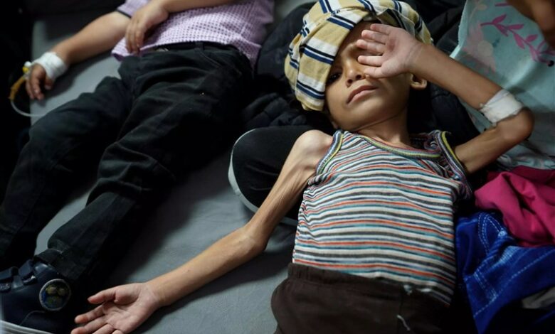 9 out of 10 children in Gaza suffer from malnutrition