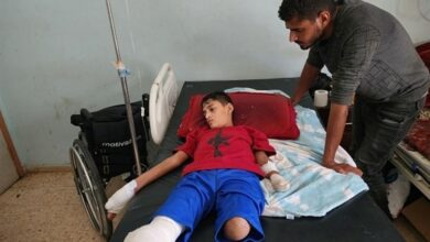 Day 264 of Al-Aqsa storm UNRWA announced the amputation of 2,000 children’s legs