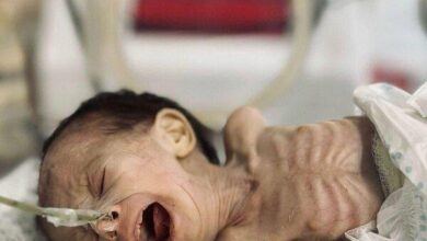 Martyrdom of another Palestinian child in Gaza due to hunger