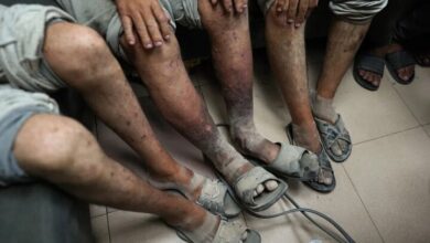 The effects of torture and malnutrition on the bodies of prisoners released from Israeli prisons