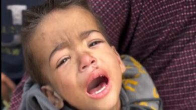 World Health Organization: The people of Gaza are hungry