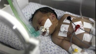 Gaza Strip Critical St.; Three Palestinian babies freezed from cold