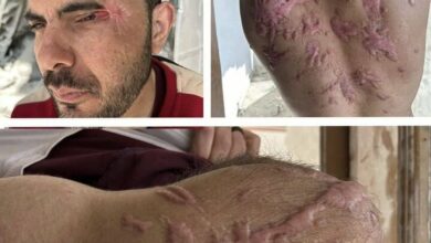 Works of Zionist brutal torture on the body of the released Palestinian+ Movie